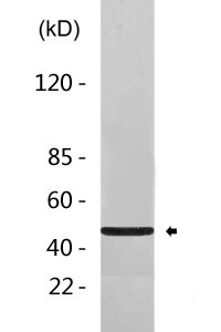 Acrosin Polyclonal Antibody