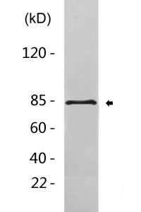 ADAM10 Polyclonal Antibody