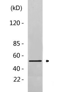 Cleaved-C1r HC (R463) Polyclonal Antibody