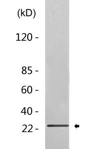 Cleaved-C1r LC (I464) Polyclonal Antibody