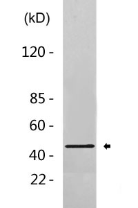 Cathepsin D Polyclonal Antibody