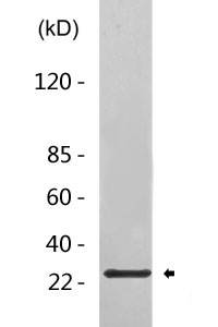 Cleaved-Cathepsin D HC (L169) Polyclonal Antibody