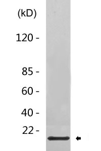 Cleaved-Cathepsin D LC (G65) Polyclonal Antibody