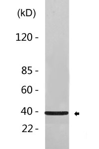 Cathepsin H Polyclonal Antibody