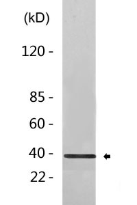 Cathepsin H Polyclonal Antibody