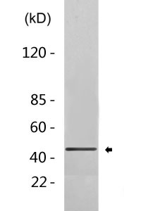 Cleaved-Cathepsin L2 (L114) Polyclonal Antibody