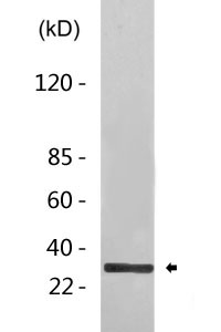 Cleaved-CD97β (S531) Polyclonal Antibody