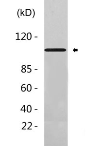 Cleaved-Notch 1 (V1754) Polyclonal Antibody