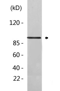 Cleaved-PARP-1 (G215) Polyclonal Antibody