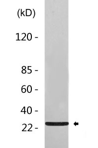 Cleaved-Tumstatin (P1426) Polyclonal Antibody