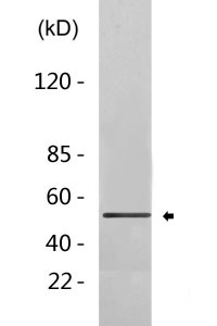 Cleaved-Factor XII HC (I20) Polyclonal Antibody