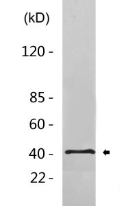 Cleaved-Factor XII HC (R372) Polyclonal Antibody