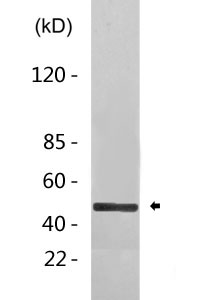 Cleaved-GGT4 HC (T472) Polyclonal Antibody