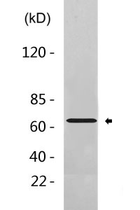 HABP2 Polyclonal Antibody