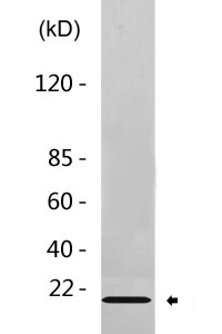 Cleaved-Integrin α5 LC (E895) Polyclonal Antibody