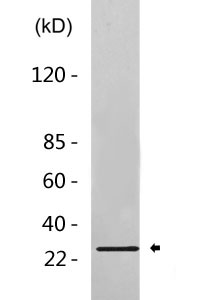 Cleaved-Integrin α6 LC (E942) Polyclonal Antibody