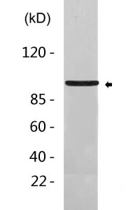 Cleaved-Integrin αV HC (K889) Polyclonal Antibody