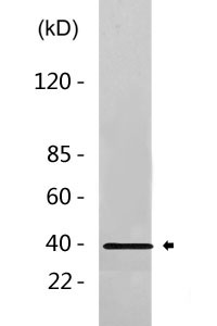 Cleaved-Kininogen-1 HC (K380) Polyclonal Antibody