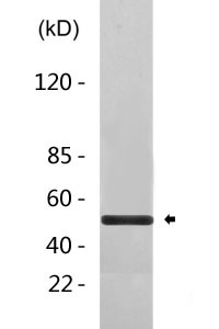 MMP-1 Polyclonal Antibody