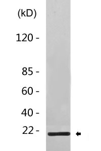 Cleaved-MMP-1 22k (F100) Polyclonal Antibody