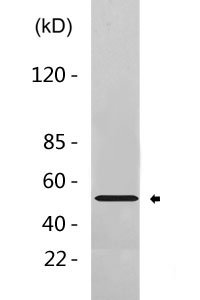 Cleaved-Plasminogen HC A short form (V98) Polyclonal Antibody