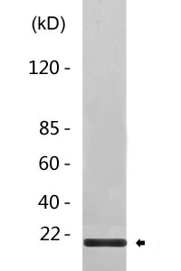 His-tag Polyclonal Antibody