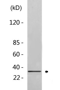 FLAG-tag Polyclonal Antibody