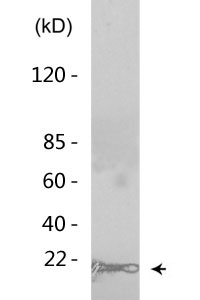 Histone H3 (Mono Methyl Lys5) Polyclonal Antibody