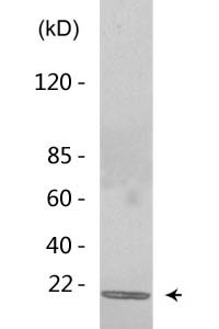 Histone H3 (Di Methyl Lys5) Polyclonal Antibody