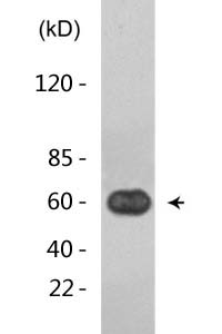 NFκB-p65 (Mono Methyl Lys314/Lys315) Polyclonal Antibody