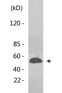 p53 (Di Methyl Lys370) Polyclonal Antibody