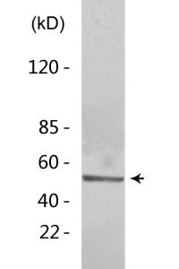 p53 (Mono Methyl Lys370) Polyclonal Antibody