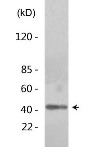 Acetyl p53 (K319) Polyclonal Antibody