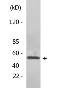 p53 (Acetyl Lys381) Polyclonal Antibody