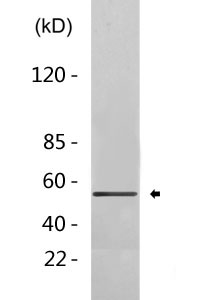 Acetyl p53 (K386) Polyclonal Antibody