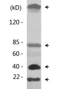 Acetyl Lys proteins Polyclonal Antibody