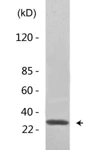 ATF-5 (Acetyl Lys29) Polyclonal Antibody