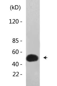 HNF-3α/β/γ (Acetyl Lys264/253/211) Polyclonal Antibody