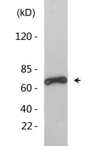 Ku-70 (Acetyl Lys539) Polyclonal Antibody