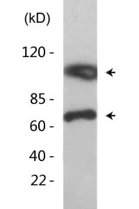 Ku-70 (Acetyl Lys542) Polyclonal Antibody