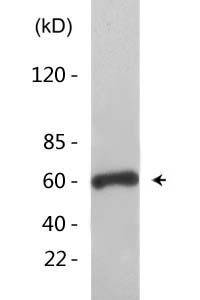 NFκB-p65 (Acetyl Lys218) Polyclonal Antibody