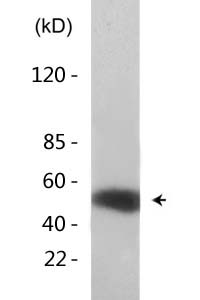 p53 (Acetyl Lys370) Polyclonal Antibody