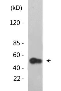 p53 (Acetyl Lys372) Polyclonal Antibody