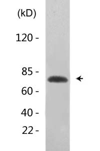 p73 (Acetyl Lys321) Polyclonal Antibody