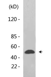 Tubulin α (Acetyl Lys352) Polyclonal Antibody