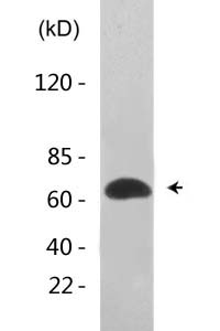 Cytokeratin-pan (Acetyl Lys194) Polyclonal Antibody