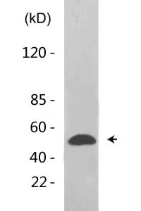 p53 (Acetyl Lys373) Polyclonal Antibody