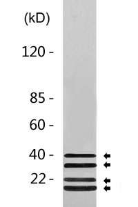 Ub (Acetyl Lys27) Polyclonal Antibody