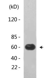 NFκB-p65 (Acetyl Lys314/Lys315) Polyclonal Antibody