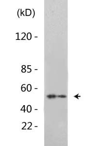 PTEN (Acetyl Lys402) Polyclonal Antibody